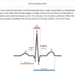 An example of course materials on ECG.